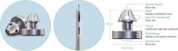 Glaukos, I-Stent Inject - Trattamento del glaucoma - immagine 4